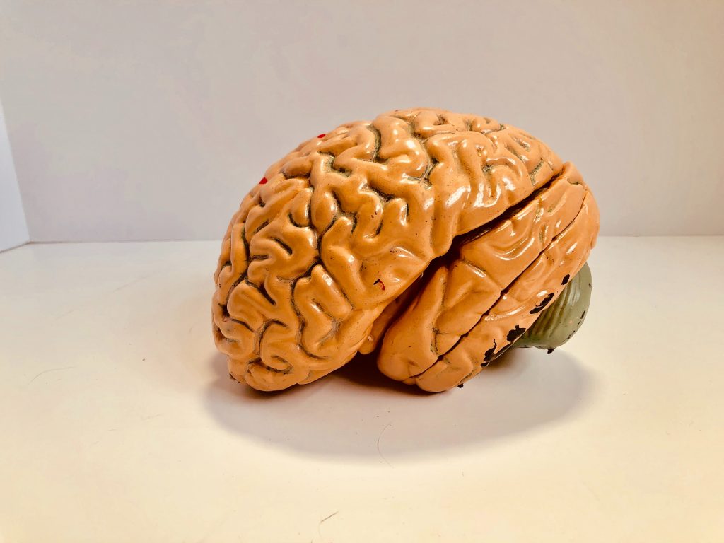 Brein onderzoek bij dementie